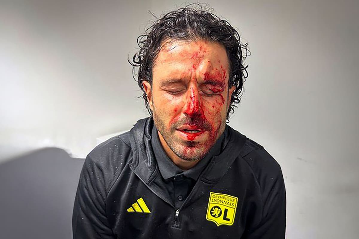 Fabio Grosso, DT de Olympique de Lyon fue agregido por los hinchas del Marseilla en la llegada al estadio Velodrome y el partido fue suspendido