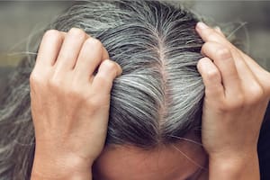 Factores como el estrés pueden generar canas