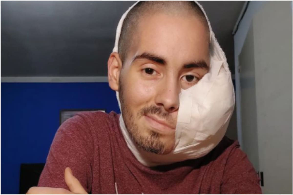 Falleció Sebastián Amurín, el joven de 25 años que tenía un tumor en el rostro