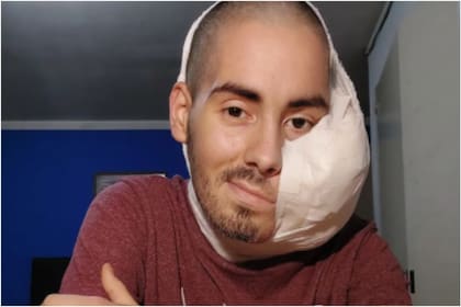 Falleció Sebastián Amurín, el joven de 25 años que tenía un tumor en el rostro