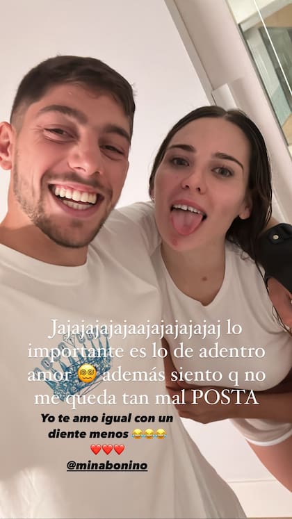 Fede Valverde compartió una divertida selfie con Mina Bonino y el diente roto