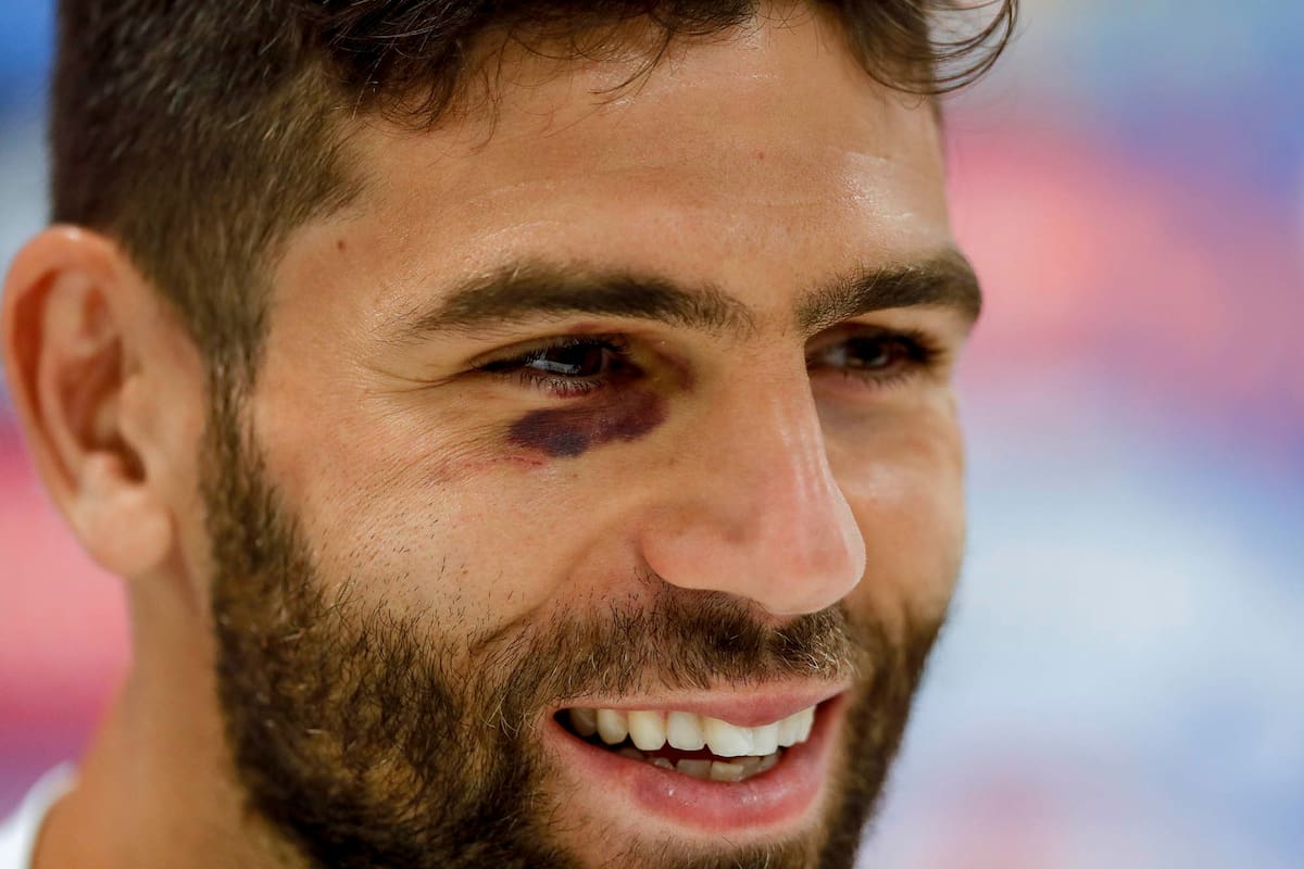 Federico Fazio con el ojo morado en la conferencia de prensa en Bronnitsy