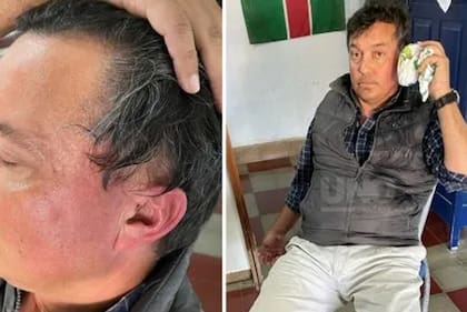 Otra postal del ataque