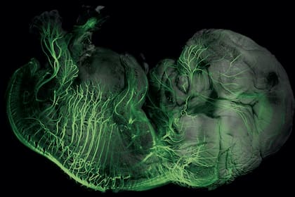 Feto de ocho semanas tomada con las técnicas del neurobiólogo Alain Chédotal