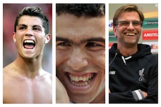 El tremendo cambio en los futbolistas que se hicieron un mismo retoque facial