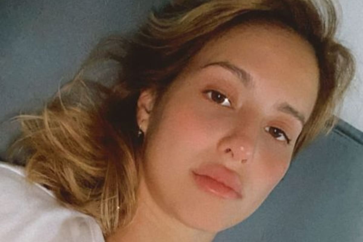 Flor Vigna mostró una reacción alérgica y sorprendió a sus seguidores al estar irreconocible