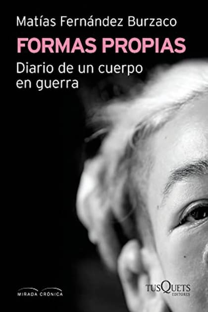 "Formas propias", de Fernández Burzaco