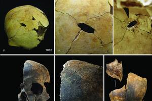 Fragmentos de cráneo, con indicios de traumatismo por objeto contundente y cortes, hallados en la fosa común de Charterhouse Warren, en el suroeste de Inglaterra