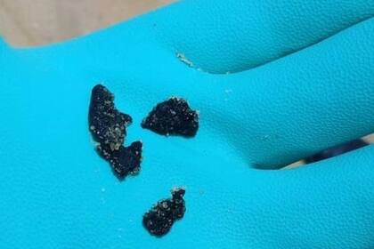 Fragmentos de petróleo encontrados en São João da Barra