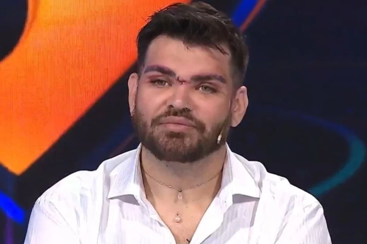 Fran Mariano está internado y podría ser amputado (Captura video)