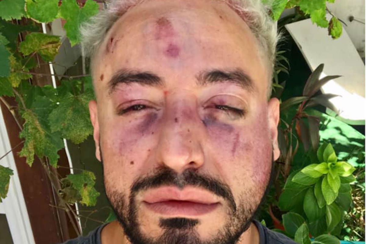 Franco Ruiz denunció en una publicación de Facebook que 15 jóvenes lo agredieron con piedras y baldosas
