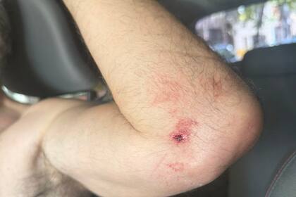 Fue gravemente herido y trasladado inmediatamente al hospital