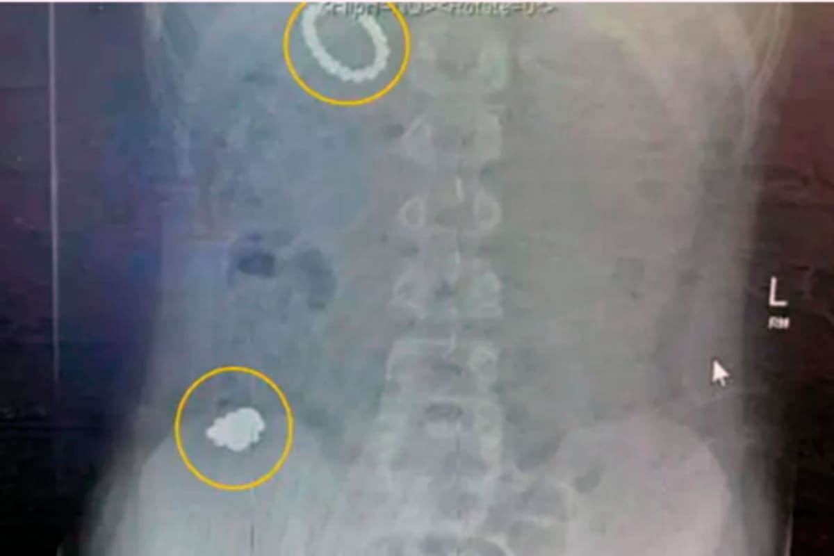 "Fue una lección realmente traumática para los dos", contó la madre