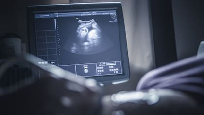 Fueron las pacientes quienes impulsaron el cambio, para que el nombre reflejara su realidad