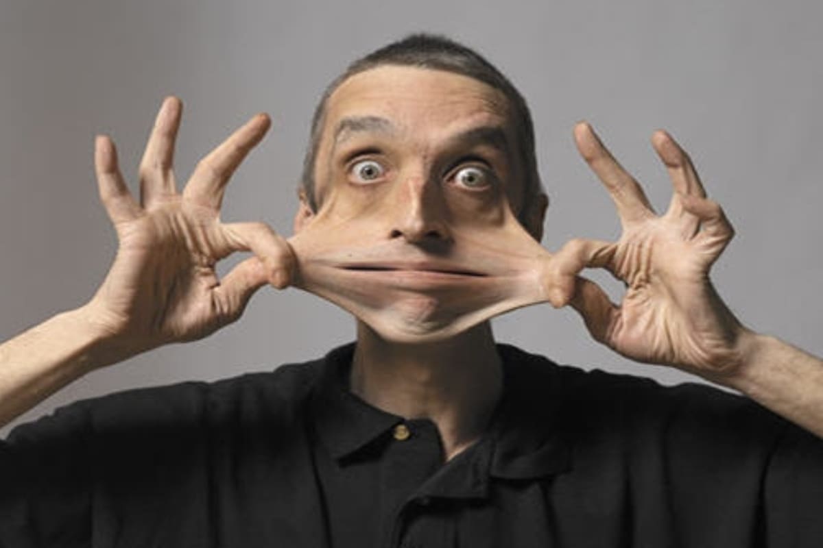 Garry Turner, el hombre con la piel "más elástica del mundo", según el libro de récords Guinness