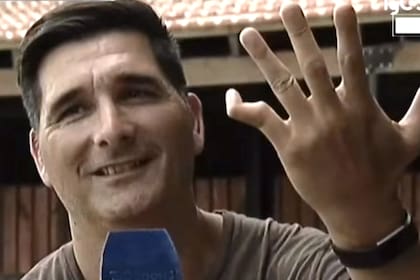 Gastón Sessa muestra el dedo meñique de su mano izquierda