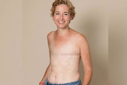 Gemma Cockrell decidió no hacerse una cirugía reconstructiva ya que se siente bien con su aspecto