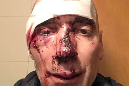 Motociclistas atacaron a Germán Martínez, un runner que se entrenaba para la maratón del próximo domingo que se disputará en Buenos Aires