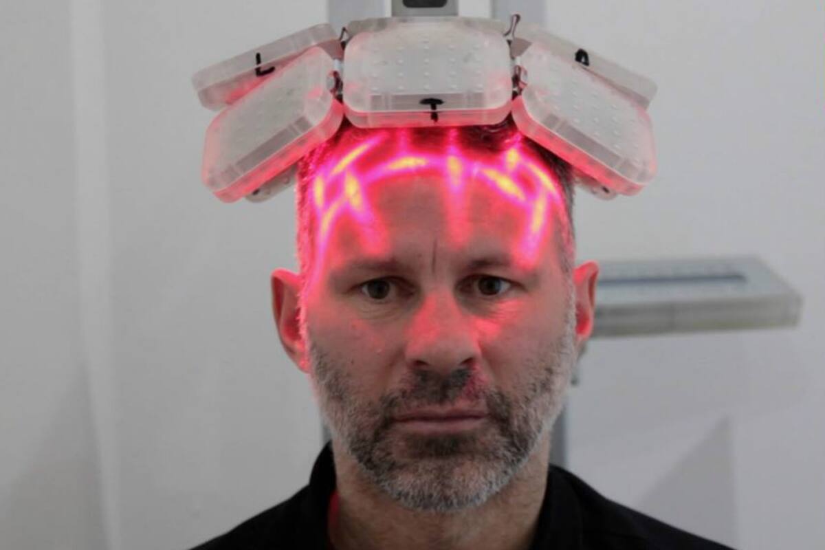 Giggs se sometió a un transplante capilar y se volvió inverso en la compañía MHR Clinic