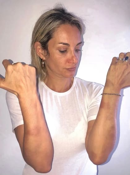 Gimena Martinazzo denunció en noviembre pasado que fue golpeada por su entonces pareja, el diputado nacional Eduardo Cáceres