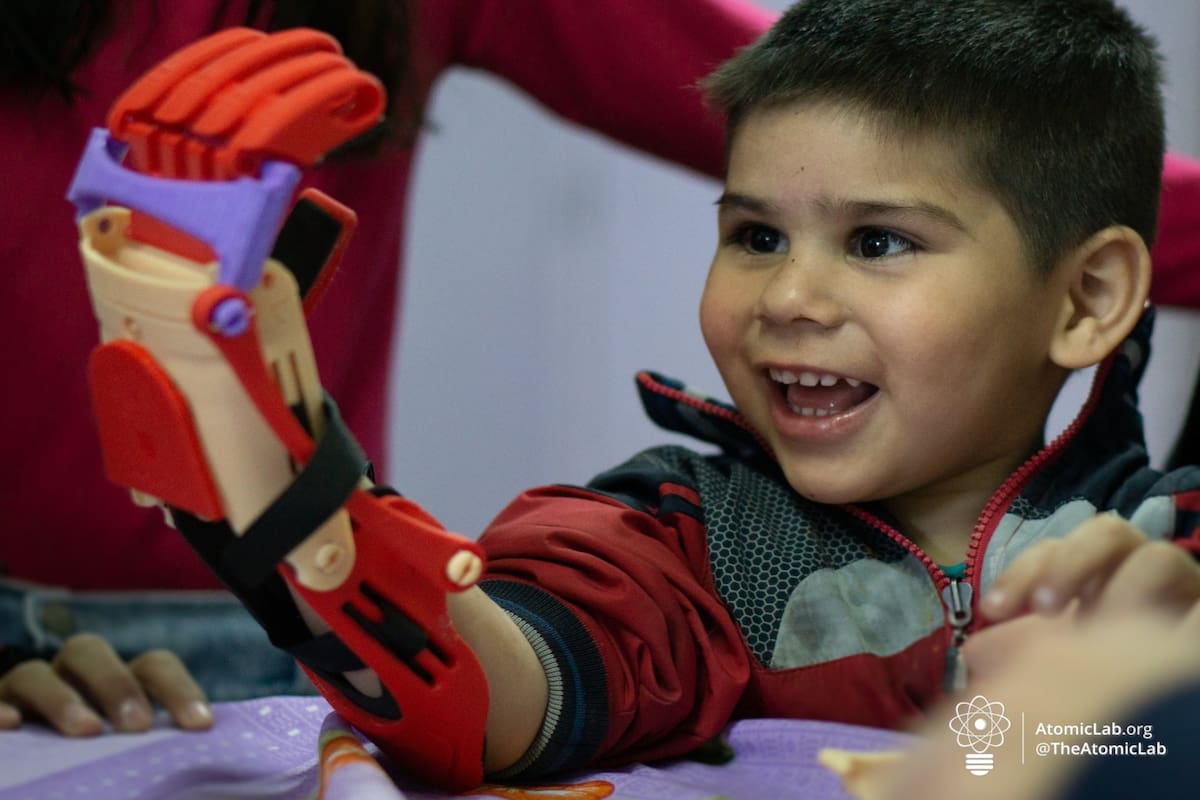 Gino Tubaro ya entregó más de 1200 prótesis gratuitas a niños de varios países