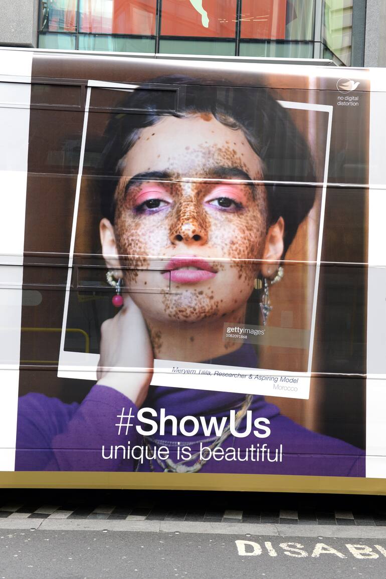 Girlgaze, Dove y Getty Images se unieron para potenciar el alcance de la propuesta a nivel global.