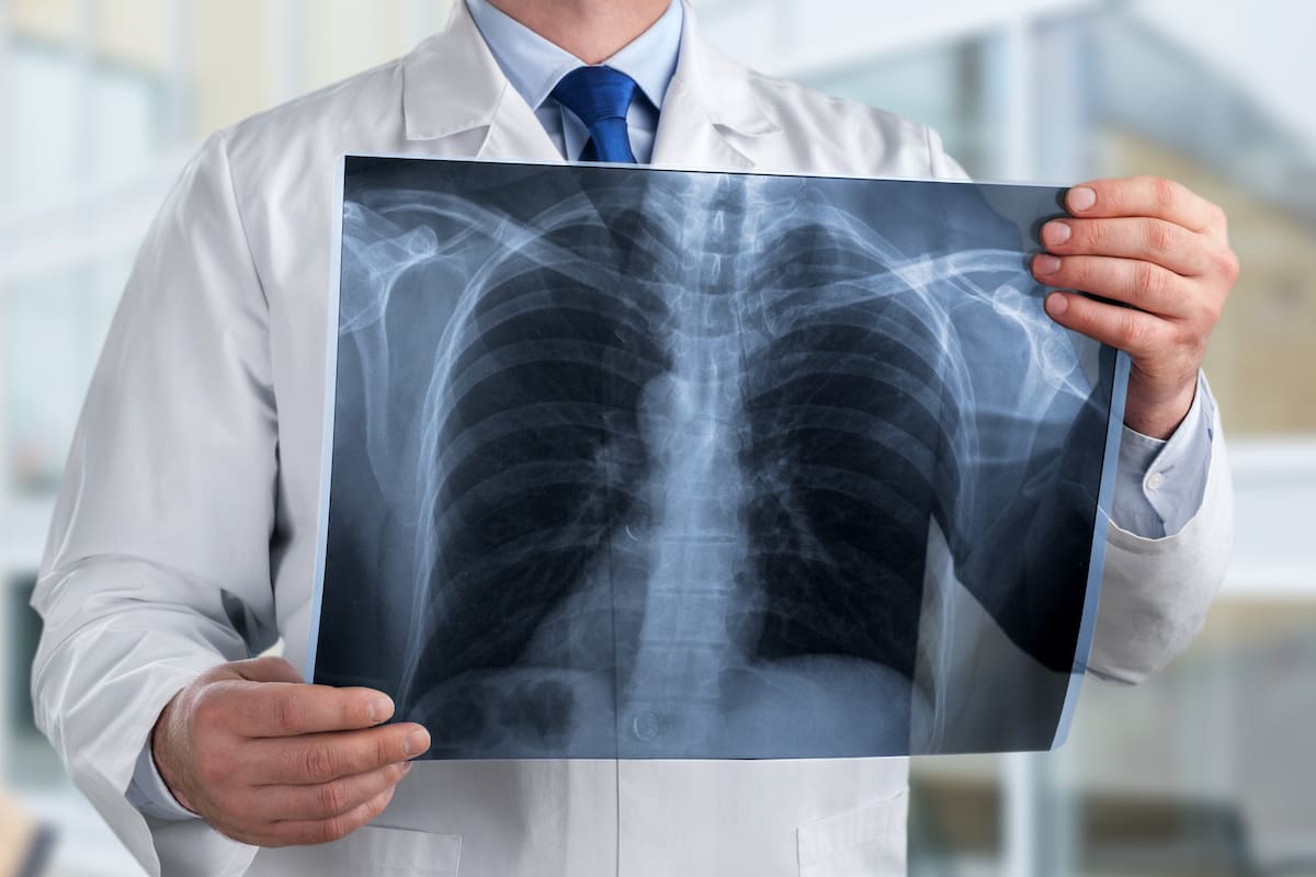 Google destacó un proyecto de investigación de la Universidad Nacional del Litoral que busca detectar sesgos en los algoritmos aplicados al análisis de imágenes médicas