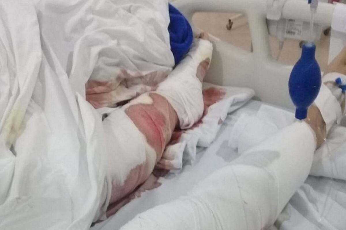 Gravísimas lesiones en piernas y brazos sufrió una mujer, mordida por tres perros ovejero alemán mientras caminaba por la playa.