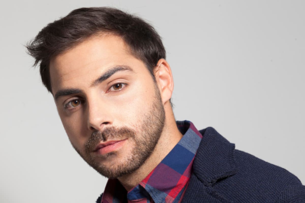 Grego Rossello se hizo un implante capilar y lo compartió en sus redes