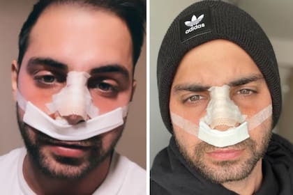 Grego Rosselló volvió a pasar por el quirófano por segunda vez en un mismo mes luego de protagonizar un accidente durante un partido de básquet