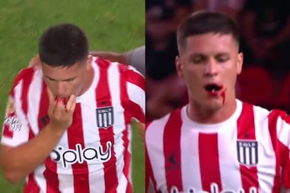 Guido Carrillo recibió un codazo de Javier Toledo y perdió tres dientes en el Estudiantes vs. Sarmiento