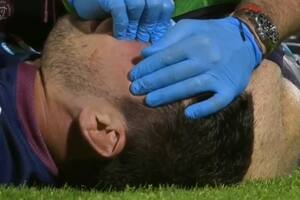 Guido Petti sufrió una fractura en el tabique y tuvo que ser operado, pero estará disponible para el próximo partido con Bordeaux Begles