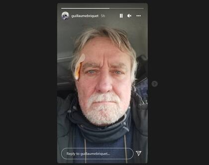 Guillaume Briquet tras los disparos rusos