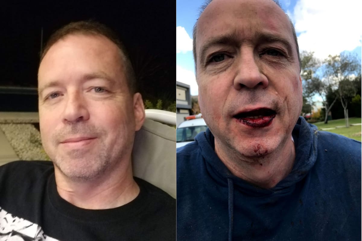 Guillermo Salgado, el vecino que denunció a Yao Cabrera por lesiones.