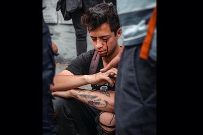 Gustavo Gatica perdió dos ojos durante la represión a las manifestaciones en Chile. Su imagen está en la portada del informe entregado al Papa