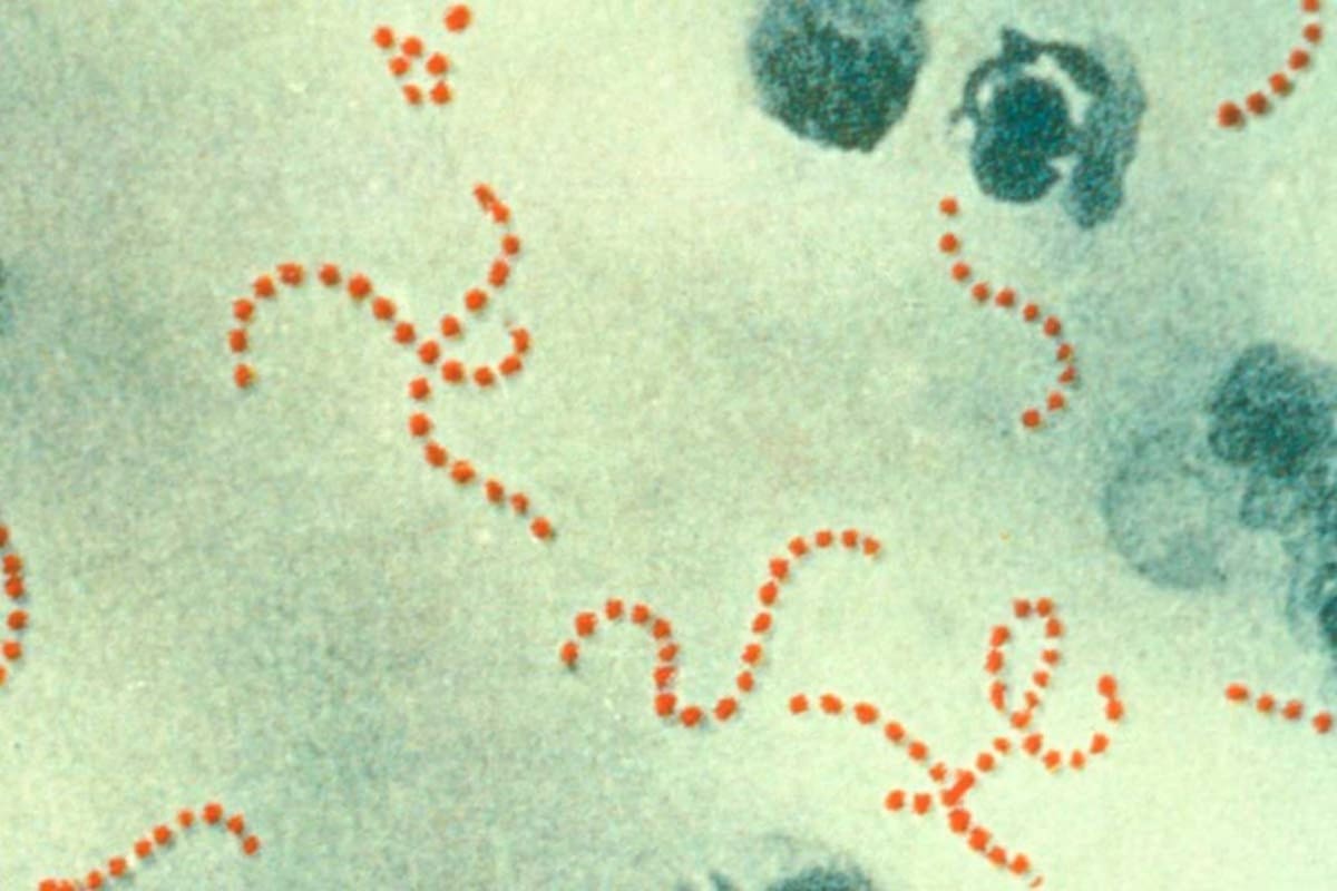 Hallan en un diente de hace 700 años la presencia de la bacteria S. pyogenes, que causa la escarlatina