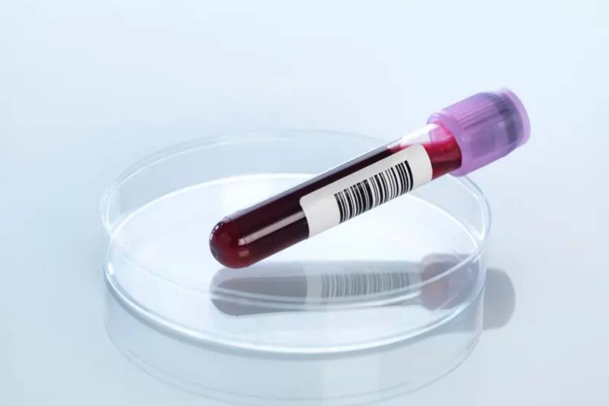 Hallaron señales moleculares asociadas al cáncer en muestras de sangre obtenidas años antes del diagnóstico; los investigadores buscan entender qué significan esas huellas