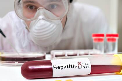 Hasta el martes eran seis los países latinoamericanos que habían reportado casos probables de hepatitis aguda infantil de origen desconocido
