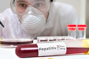 Hasta el martes eran seis los países latinoamericanos que habían reportado casos probables de hepatitis aguda infantil de origen desconocido