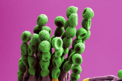 Hay cientos de especies en el género de hongos Pennicillium, uno de los más comunes en la Estación Espacial Internacional