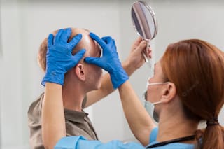 Este es el tratamiento que podría traer la cura para la caída del cabello