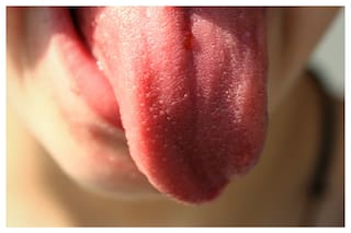Qué significa tener la lengua blanca