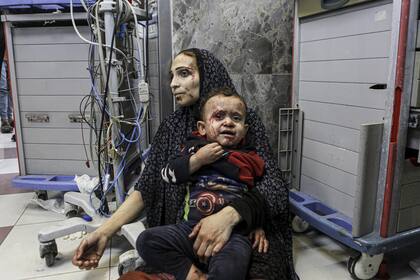 Heridos palestinos en un hospital de Gaza, en plena escalada del conflicto en Medio Oriente