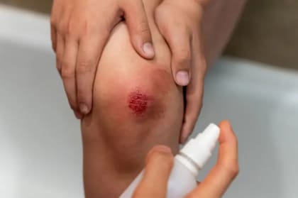 Hoy, hay alternativas mucho menos riesgosas disponibles en el mercado