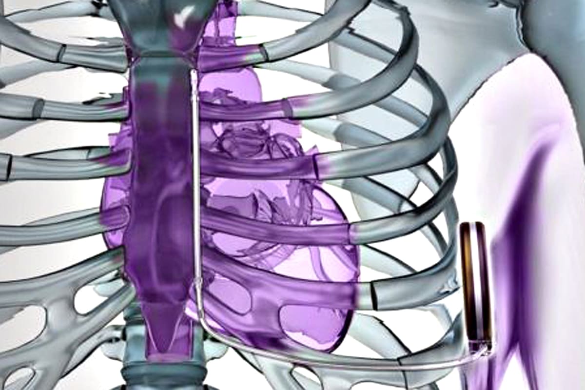 Hoy se celebra el Día Mundial del Corazón