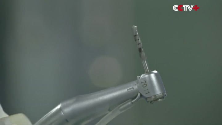 El primer implante dental robotizado del mundo se hizo en China
