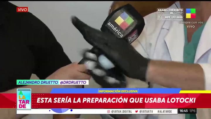 La salud de Silvina Luna: un médico cirujano preparó el metacrilato en vivo y mostró cómo se endurece dentro del cuerpo