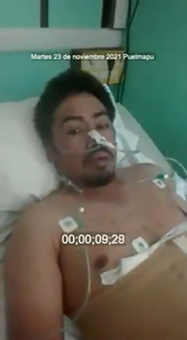 El mapuche herido llamó a 'seguir ocupando el territorio'