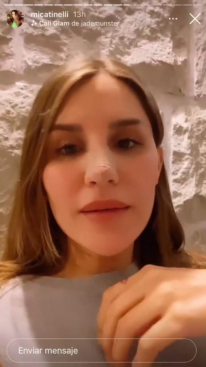 Micaela Tinelli contra los que la critican por su nueva nariz - Fuente: IG Stories