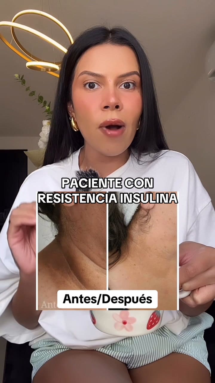 Cinco formas naturales de adquirir vitamina D